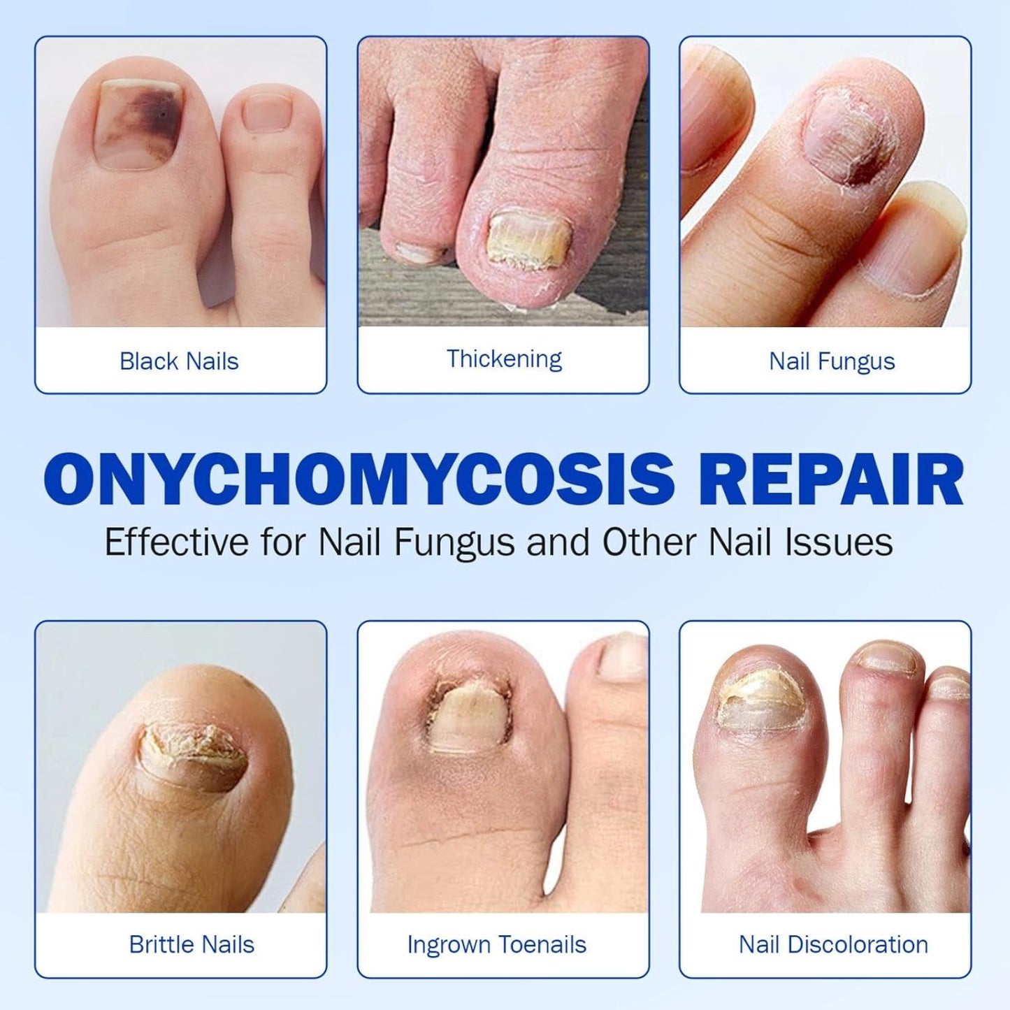 Toenail Fungus Treatment Extra Strength