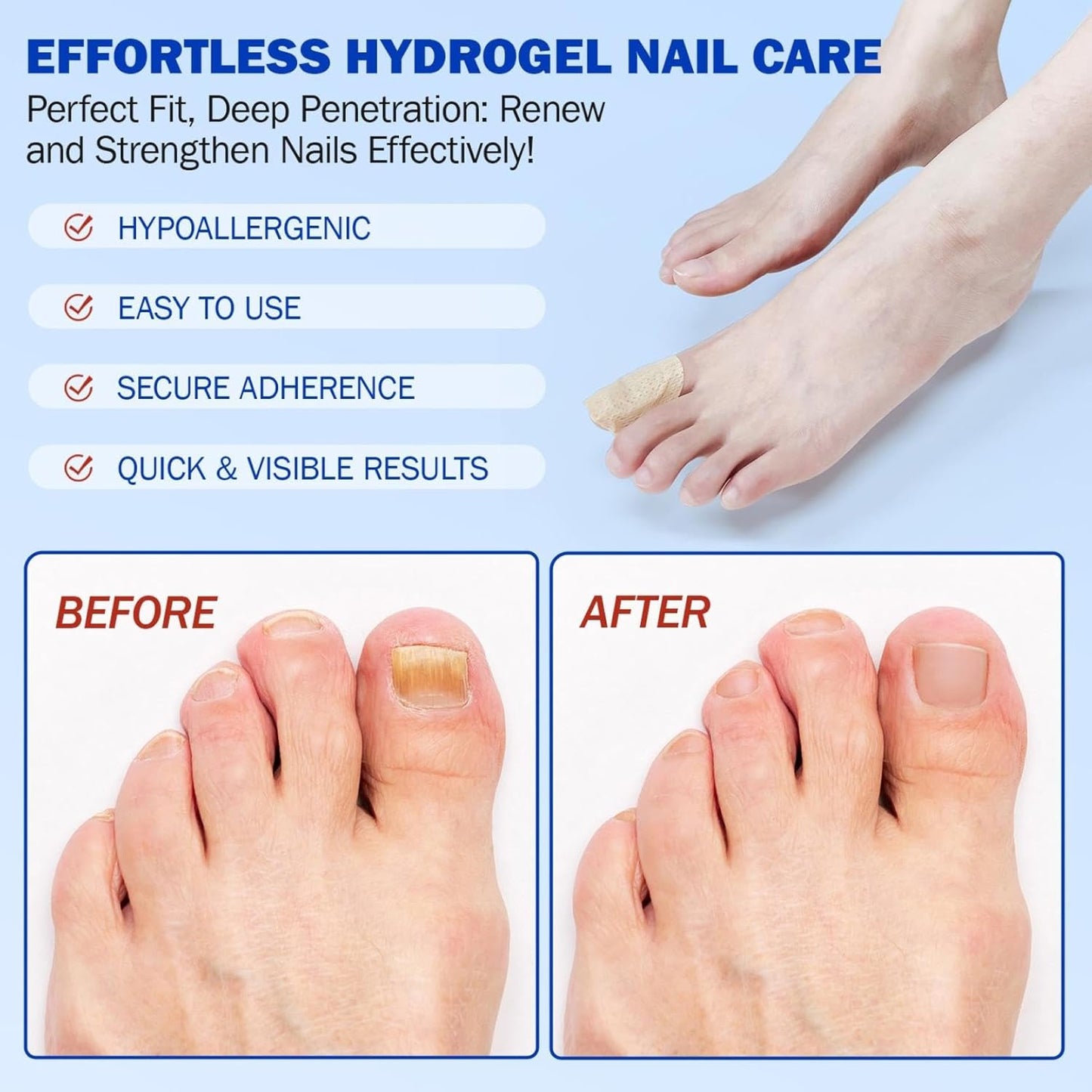 Toenail Fungus Treatment Extra Strength